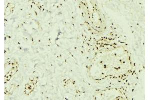 ABIN6269369 at 1/100 staining Mouse muscle tissue by IHC-P. (SMAD1 Antikörper)