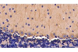 Detection of TNFa in Mouse Cerebellum Tissue using Polyclonal Antibody to Tumor Necrosis Factor Alpha (TNFa) (TNF alpha Antikörper  (AA 80-235))