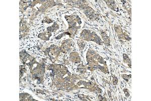 IHC analysis of CDR2 using anti-CDR2 antibody (ABIN7599397).