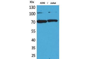 Western Blotting (WB) image for anti-X-Ray Repair Complementing Defective Repair in Chinese Hamster Cells 6 (XRCC6) (Ser403) antibody (ABIN3187845) (XRCC6 Antikörper  (Ser403))