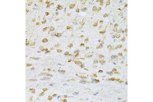 Immunohistochemistry of paraffin-embedded mouse brain using VAPB Antibody (ABIN1876551) at dilution of 1:200 (40x lens). (VAPB Antikörper)