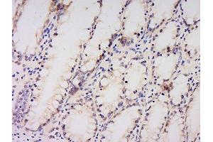 Formalin-fixed and paraffin embedded human kidney labeled with Anti-AMPK alpha-1 Polyclonal Antibody, Unconjugated  at 1:200 followed by conjugation to the secondary antibody and DAB staining. (PRKAA1 Antikörper  (AA 351-450))