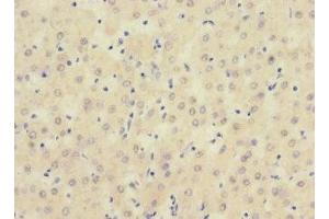 Immunohistochemistry (IHC) image for anti-Single Immunoglobulin and Toll-Interleukin 1 Receptor (TIR) Domain (SIGIRR) (AA 1-120) antibody (ABIN7169723)