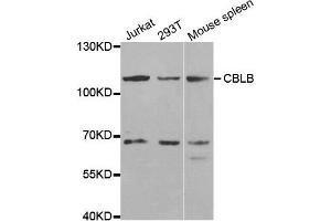 Western blot analysis of extracts of various cell lines, using CBLB antibody. (Cbl Proto-Oncogene B, E3 Ubiquitin Protein Ligase (CBLB) Antikörper)