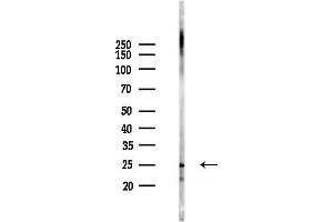 anti-Lysosomal Protein Transmembrane 5 (LAPTM5) antibody