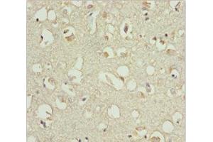 Immunohistochemistry of paraffin-embedded human brain tissue using ABIN7151541 at dilution of 1:100 (EEF1B2 Antikörper  (AA 1-225))