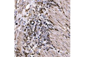 IHC analysis of KLF15 using anti-KLF15 antibody (ABIN7599269). (KLF15 Antikörper  (AA 1-323))