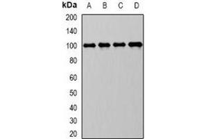 Western blot analysis of CD10 expression in Raji (A), MCF7 (B), mouse kidney (C), mouse liver (D) whole cell lysates. (MME Antikörper)