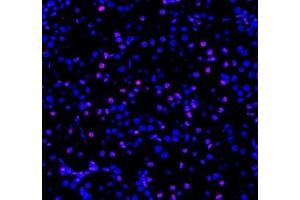 Immunofluorescent analysis of paraformaldehyde-fixed rat kidney using ADRA1B (ABIN7072974) at dilution of 1: 1200 (ADRA1B Antikörper)