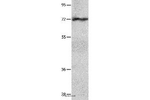 Western blot analysis of Hela cell  , using IGF2BP1 Polyclonal Antibody at dilution of 1:750 (IGF2BP1 Antikörper)