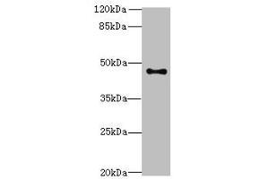 Western blot analysis of PC-3 whole cell lysates, using AADACL2 antibody (2 μg/ml) and Goat anti-Rabbit polyclonal secondary antibody (1/10000 dilution). (AADACL2 Antikörper  (AA 181-379))