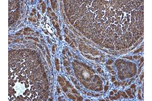 IHC-P Image ATG4D antibody [N3C3] detects ATG4D protein at cytoplasm in mouse ovary by immunohistochemical analysis.