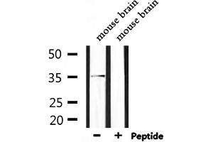 Western blot analysis of extracts from mouse brain, using Olfactory receptor 5AP2 Antibody. (OR5AP2 Antikörper)
