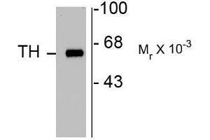 Image no. 1 for anti-Tyrosine Hydroxylase (TH) antibody (ABIN372734) (Tyrosine Hydroxylase Antikörper)