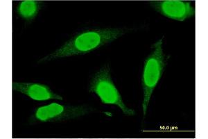 Immunofluorescence of monoclonal antibody to THAP11 on HeLa cell.