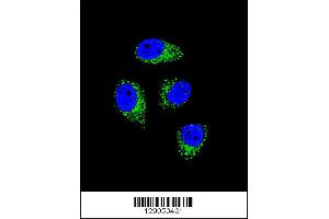 Confocal immunofluorescent analysis of WDR52 Antibody with A549 cell followed by Alexa Fluor 488-conjugated goat anti-rabbit lgG (green). (WDR52 Antikörper  (C-Term))
