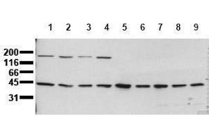 Western Blotting (WB) image for anti-Mitogen-Activated Protein Kinase Kinase 1 (MAP2K1) antibody (ABIN126835) (MEK1 Antikörper)