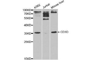 Western blot analysis of extracts of various cell lines, using CD1D antibody. (CD1d Antikörper  (AA 20-190))