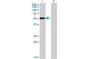 Western Blot analysis of ZNF232 expression in transfected 293T cell line by ZNF232 monoclonal antibody (M06), clone 1F8. (ZNF232 Antikörper  (AA 181-280))