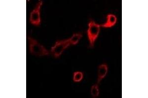 Immunofluorescent analysis of Adenosine Deaminase staining in Jurkat cells.