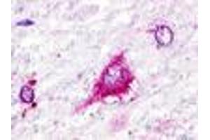 Anti-GPR22 antibody IHC of human brain, neurons and glia. (GPR22 Antikörper  (Cytoplasmic Domain))