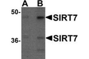 Western blot analysis of SIRT7 in 293 cell lysate with SIRT7 antibody at (A) 0. (SIRT7 Antikörper  (N-Term))