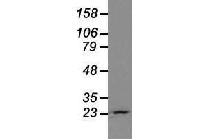 Western blot analysis of extracts (35 µg) from 9 different cell lines by using anti-NEUROG1 monoclonal antibody. (Neurogenin 1 Antikörper)