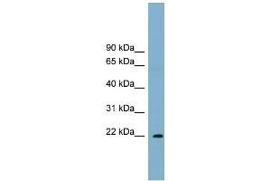 WB Suggested Anti-PCNP Antibody Titration: 0.