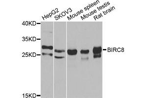 Western blot analysis of extracts of various cell lines, using BIRC8 antibody (ABIN2561421) at 1:1000 dilution. (ILP-2 Antikörper)