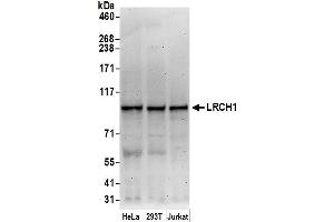 Western Blotting (WB) image for anti-Leucine-Rich Repeats and Calponin Homology (CH) Domain Containing 1 (LRCH1) (AA 325-375) antibody (ABIN7453124)
