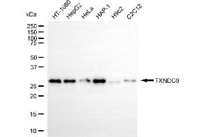 Western blotting analysis using TXNDC9 antibody (ABIN7800543).