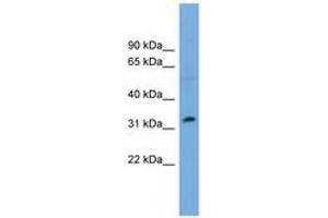 Image no. 1 for anti-PHD Finger Protein 13 (PHF13) (AA 179-228) antibody (ABIN6744908) (PHF13 Antikörper  (AA 179-228))