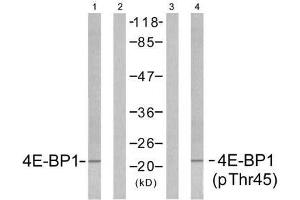 Western blot analysis of extracts from MDA-MB-435 cells untreated or treated with EGF (200ng/ml, 5min), using 4E-BP1 (Ab-45) antibody (E021216, Lane1 and 2) and 4E-BP1 (phospho-Thr45) antibody (E011223, Lane 3 and 4). (eIF4EBP1 Antikörper)