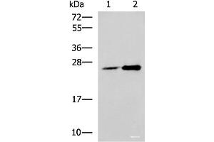 Western blot analysis of 293T cell lysates using DGCR6L Polyclonal Antibody at dilution of 1:800 (DGCR6L Antikörper)