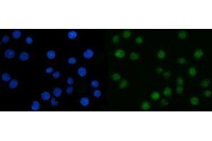 IF analysis of CSNK2A2 using anti-CSNK2A2 antibody (ABIN7602871). (CSNK2A2 Antikörper  (C-Term))