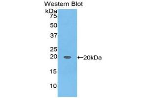 Detection of Recombinant aFP, Canine using Polyclonal Antibody to Alpha-Fetoprotein (AFP) (alpha Fetoprotein Antikörper  (AA 234-380))