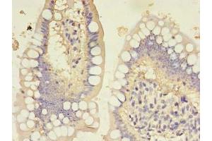 Immunohistochemistry of paraffin-embedded human small intestine tissue using ABIN7154976 at dilution of 1:100 (HBd Antikörper  (AA 2-147))