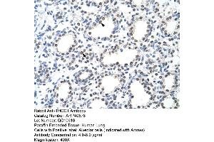 Rabbit Anti-THOC1 Antibody  Paraffin Embedded Tissue: Human Lung Cellular Data: Alveolar cells Antibody Concentration: 4.