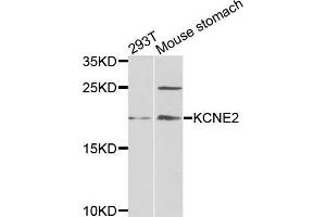 Western blot analysis of extracts of 293T and mouse stomach cells, using KCNE2 antibody. (KCNE2 Antikörper)
