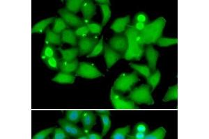 Immunofluorescence analysis of A549 cells using UBASH3B Polyclonal Antibody (UBASH3B Antikörper)