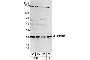 Western Blotting (WB) image for anti-Proteasome (Prosome, Macropain) Subunit, beta Type, 7 (PSMB7) (AA 150-200) antibody (ABIN7453543)