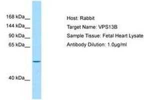 Image no. 1 for anti-Vacuolar Protein Sorting 13 Homolog B (Yeast) (VPS13B) (AA 76-125) antibody (ABIN6749989) (VPS13B Antikörper  (AA 76-125))