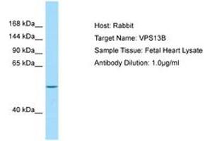 Image no. 1 for anti-Vacuolar Protein Sorting 13 Homolog B (Yeast) (VPS13B) (AA 76-125) antibody (ABIN6749989)