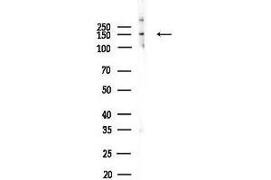 anti-AT Rich Interactive Domain 1B (SWI1-Like) (ARID1B) (Internal Region) antibody