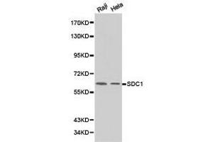 Western Blotting (WB) image for anti-Syndecan 1 (SDC1) antibody (ABIN1874708) (Syndecan 1 Antikörper)
