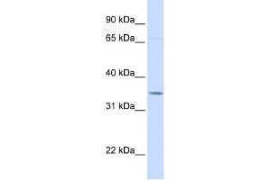 TOLLIP antibody used at 1 ug/ml to detect target protein. (TOLLIP Antikörper  (C-Term))