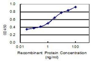 Detection limit for recombinant GST tagged ANKS4B is 0. (ANKS4B Antikörper  (AA 1-417))