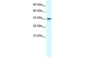 Human Jurkat; WB Suggested Anti-GFI1B Antibody Titration: 0. (GFI1B Antikörper  (N-Term))