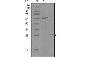 Western Blot showing PGR antibody used against truncated MBP-PGR recombinant protein (1) and truncated Trx-PGR (aa730-871) recombinant protein (2). (Progesterone Receptor Antikörper  (AA 730-871))