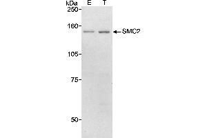 Western Blotting (WB) image for anti-Structural Maintenance of Chromosomes 2 (SMC2) (AA 50-100) antibody (ABIN7449269) (SMC2 Antikörper  (AA 50-100))
